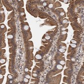 Anti-CMPK2 antibody produced in rabbit Prestige Antibodies® Powered by Atlas Antibodies, affinity isolated antibody, buffered aqueous glycerol solution