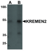 Anti-KREMEN2 antibody produced in rabbit affinity isolated antibody, buffered aqueous solution