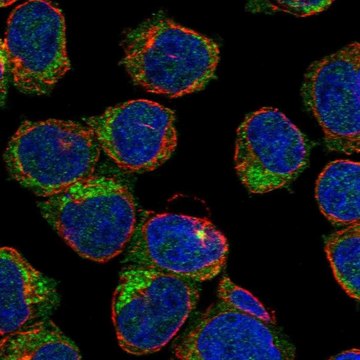 Anti-Stap1 Antibody Produced In Rabbit Prestige Antibodies&#174; Powered by Atlas Antibodies, affinity isolated antibody, buffered aqueous glycerol solution