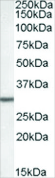 Anti-DPM1 (AB2) antibody produced in goat affinity isolated antibody, buffered aqueous solution