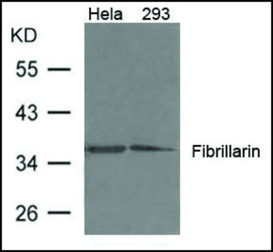 Anti-Fibrillarin antibody produced in rabbit affinity isolated antibody