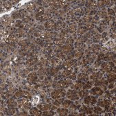 Anti-RABEP1 antibody produced in rabbit Prestige Antibodies® Powered by Atlas Antibodies, affinity isolated antibody, buffered aqueous glycerol solution, Ab1