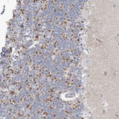 Anti-MTHFD2L antibody produced in rabbit Prestige Antibodies® Powered by Atlas Antibodies, affinity isolated antibody, buffered aqueous glycerol solution