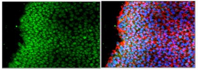 Anti-Rex-1 Antibody from rabbit, purified by affinity chromatography