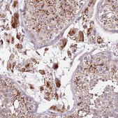 Anti-DOCK6 antibody produced in rabbit Prestige Antibodies® Powered by Atlas Antibodies, affinity isolated antibody, buffered aqueous glycerol solution