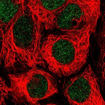 Anti-SLC17A9 antibody produced in rabbit Prestige Antibodies&#174; Powered by Atlas Antibodies, affinity isolated antibody