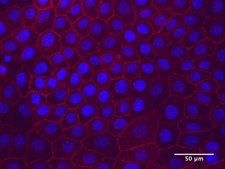 Anti-CD167a/DDR1 Antibody, clone 5D5 clone 5D5, from mouse