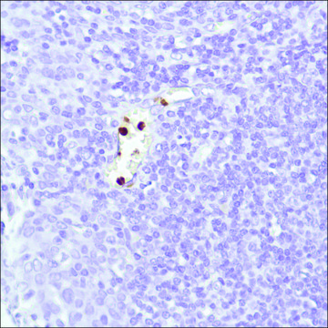 Anti-Neutrophil Elastase antibody, Rabbit monoclonal recombinant, expressed in proprietary host, clone SP203, affinity isolated antibody