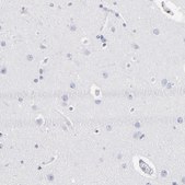 Anti-CD180 antibody produced in rabbit Prestige Antibodies® Powered by Atlas Antibodies, affinity isolated antibody, buffered aqueous glycerol solution