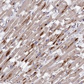 Anti-TK2 antibody produced in rabbit Prestige Antibodies® Powered by Atlas Antibodies, affinity isolated antibody, buffered aqueous glycerol solution