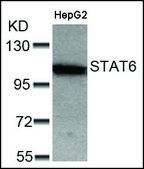 Anti-STAT6 (Ab-641) antibody produced in rabbit affinity isolated antibody