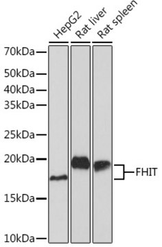 Anti-FHIT Antibody, clone 3Z1U4, Rabbit Monoclonal