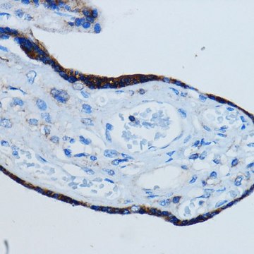 Anti-MMP2 antibody produced in rabbit