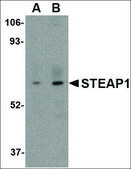 Anti-STEAP1 (ab1) antibody produced in rabbit affinity isolated antibody, buffered aqueous solution
