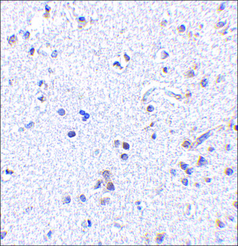 Anti-TSLP (ab1) antibody produced in rabbit affinity isolated antibody, buffered aqueous solution