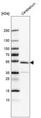 Anti-ZNF692 antibody produced in rabbit Prestige Antibodies® Powered by Atlas Antibodies, affinity isolated antibody, buffered aqueous glycerol solution