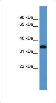 Anti-ATP1B2 antibody produced in rabbit affinity isolated antibody