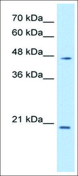 Anti-PAX6 (AB2) antibody produced in rabbit affinity isolated antibody