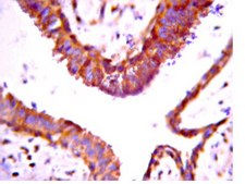 抗FOXO1抗体，克隆2H8.2 clone 2H8.2, from mouse