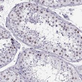 Anti-SGO1 antibody produced in rabbit Prestige Antibodies® Powered by Atlas Antibodies, affinity isolated antibody