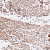 Anti-IMMT antibody produced in rabbit Prestige Antibodies® Powered by Atlas Antibodies, affinity isolated antibody, buffered aqueous glycerol solution