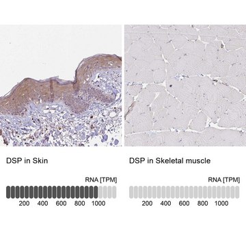 Anti-DSP antibody produced in rabbit Prestige Antibodies&#174; Powered by Atlas Antibodies, affinity isolated antibody, buffered aqueous glycerol solution