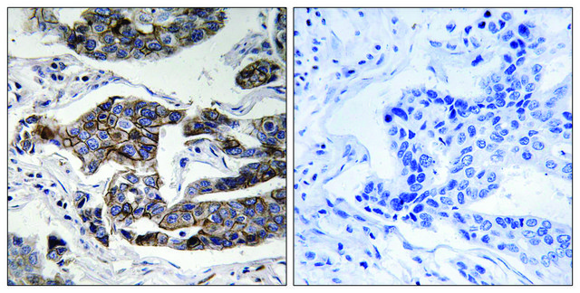 Anti-phospho-Girdin (pSer1417) antibody produced in rabbit affinity isolated antibody