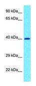 Anti-IL3RA (C-terminal) antibody produced in rabbit affinity isolated antibody