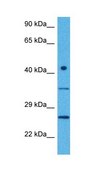 Anti-DULLARD antibody produced in rabbit affinity isolated antibody