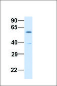 Anti-ZBTB7A antibody produced in rabbit affinity isolated antibody