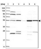 Anti-FKBP5 antibody produced in rabbit Prestige Antibodies® Powered by Atlas Antibodies, affinity isolated antibody, buffered aqueous glycerol solution