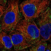 Anti-PHLPP2 antibody produced in rabbit Prestige Antibodies® Powered by Atlas Antibodies, affinity isolated antibody, buffered aqueous glycerol solution