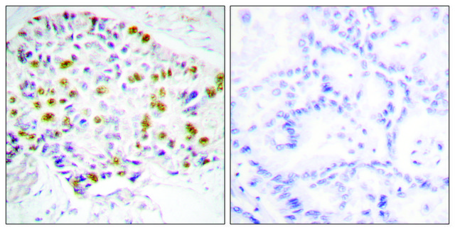 Anti-Retinoblastoma antibody produced in rabbit affinity isolated antibody