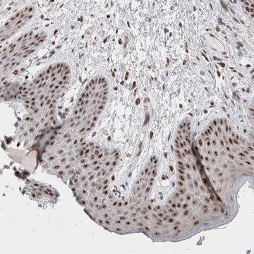 Anti-SENP6 antibody produced in rabbit Prestige Antibodies® Powered by Atlas Antibodies, affinity isolated antibody, buffered aqueous glycerol solution