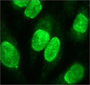 Anti-SOX11 (C-terminal) antibody produced in rabbit IgG fraction of antiserum