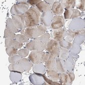 Anti-NT5C2 antibody produced in rabbit Prestige Antibodies® Powered by Atlas Antibodies, affinity isolated antibody, buffered aqueous glycerol solution