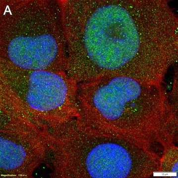 Anti-GLI-2 Antibody, clone 1G4 ZooMAb&#174; Rabbit Monoclonal recombinant, expressed in HEK 293 cells