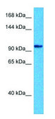 Anti-PREX2 (N-terminal) antibody produced in rabbit affinity isolated antibody