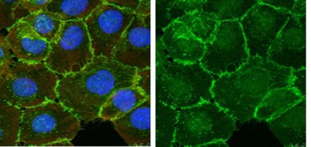 Anti-&#946;-Catenin Antibody Upstate&#174;, from rabbit