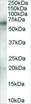 Anti-Spleen tyrosine kinase/SYK antibody produced in goat affinity isolated antibody, buffered aqueous solution