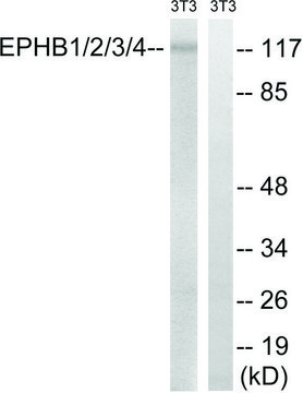 Anti-EPHB1 antibody produced in rabbit affinity isolated antibody