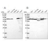 Anti-TRAP1 antibody produced in rabbit Prestige Antibodies® Powered by Atlas Antibodies, affinity isolated antibody, buffered aqueous glycerol solution
