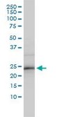 Monoclonal Anti-ZNF313 antibody produced in mouse clone 4G3-1A10, purified immunoglobulin, buffered aqueous solution