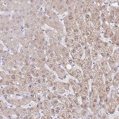 Anti-AKR1D1 antibody produced in rabbit Prestige Antibodies® Powered by Atlas Antibodies, affinity isolated antibody, buffered aqueous glycerol solution
