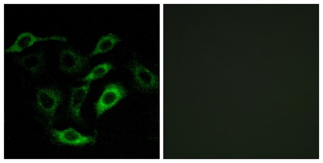 Anti-PTGDR antibody produced in rabbit affinity isolated antibody