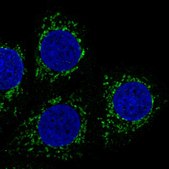 Anti-PMPCB antibody produced in rabbit Prestige Antibodies® Powered by Atlas Antibodies, affinity isolated antibody, buffered aqueous glycerol solution