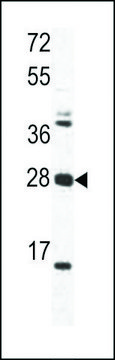 ANTI-OAZ1(N-TERMINAL) antibody produced in rabbit purified immunoglobulin, buffered aqueous solution