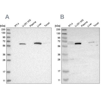 Anti-CRAT antibody produced in rabbit Prestige Antibodies&#174; Powered by Atlas Antibodies, affinity isolated antibody, buffered aqueous glycerol solution, Ab3