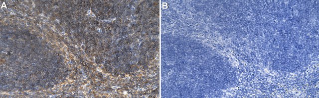 Anti-CD48 Antibody, clone 2I13 ZooMAb&#174; Rabbit Monoclonal recombinant, expressed in HEK 293 cells