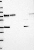 Anti-LIMK1 antibody produced in rabbit Prestige Antibodies® Powered by Atlas Antibodies, affinity isolated antibody, buffered aqueous glycerol solution